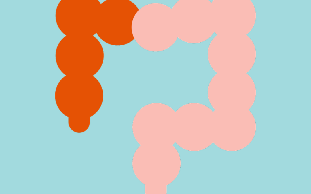 Colorectal Cancer at CommunityHealth